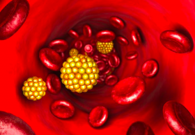 Maria Ana odgovarja: Povišan holesterol