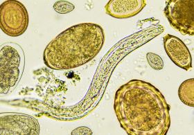 OKUŽBA S PARAZITI in RAZPARAZITENJE