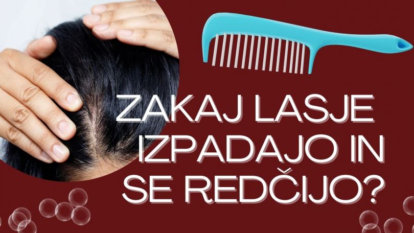 Zakaj se lasje redčijo in izpadajo – ter kako jih rešiti? Pregled rešitev