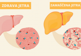 Znaki, da so jetra in črevesje v težavah, ter kako pospešiti njihovo čiščenje?