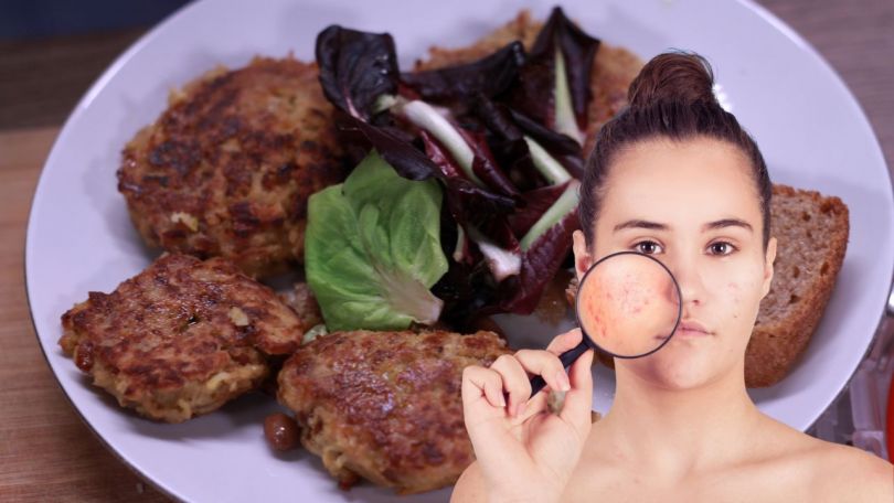 RECEPT: Imate težave z aknami? Pripravite si fižolove polpetke