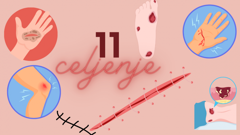 11 stvari, ki znatno pospešijo celjenje in hitrejšo regeneracijo