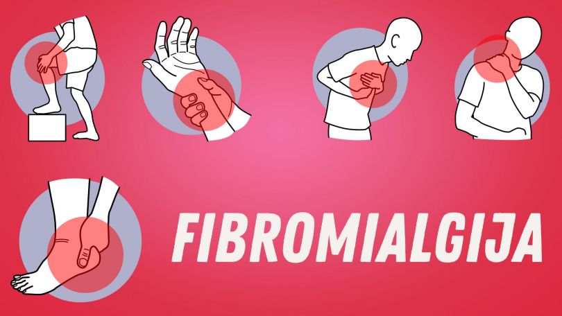 Fibromialgija: vodnik za celosten pristop