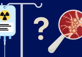 Kaj se zgodi z rakavimi celicami po kemoterapiji?