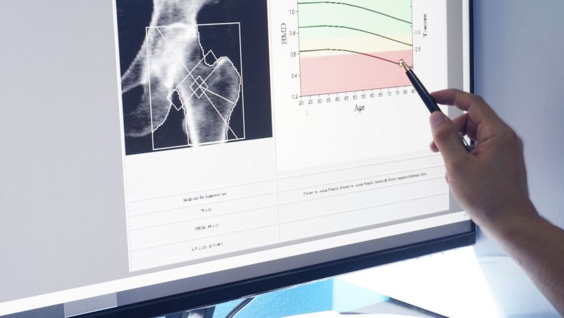 Največ škode in največ koristi za svoje kosti lahko naredimo pozimi! Navade, prehrana in dopolnila