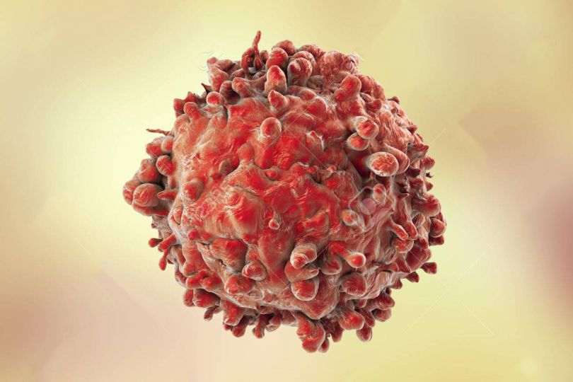 Upanje za onkološke bolnike