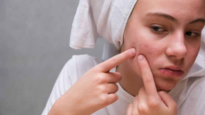 Imate doma nerodne otroke ali aknaste najstnike? Tole je rešitev