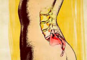 Maria Ana odgovarja: Obupno mravlinčenje v nogah po operaciji hrbtenice