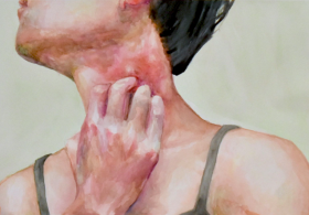 Maria Ana odgovarja: Intoleranca na pšenico in srbečica po celem telesu