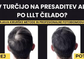 V Turčijo na presaditev las ali po čelado za profesionalno fotobiomodulacijo las in lasišča?