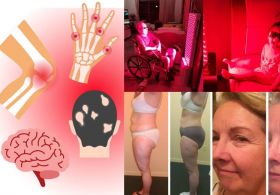 Povzetek knjige o Rdeči svetlobni terapiji (fotobiomodulaciji) avtorja Marka Sloana