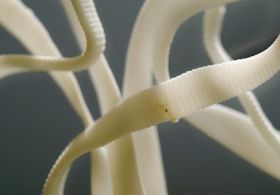 Paraziti?! Recepti ljudske medicine, ki delujejo!