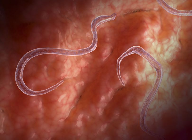 Naziv: Protiparazitni program dr. Korepanova