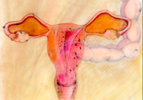 Praktično takojšnja rešitev pri menstrualnih krčih!